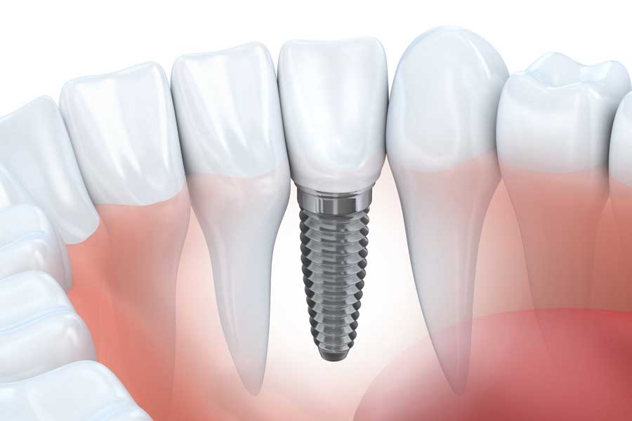 David Fopa - Zahnarztpraxis - Oralchirurgie - Implantologie
